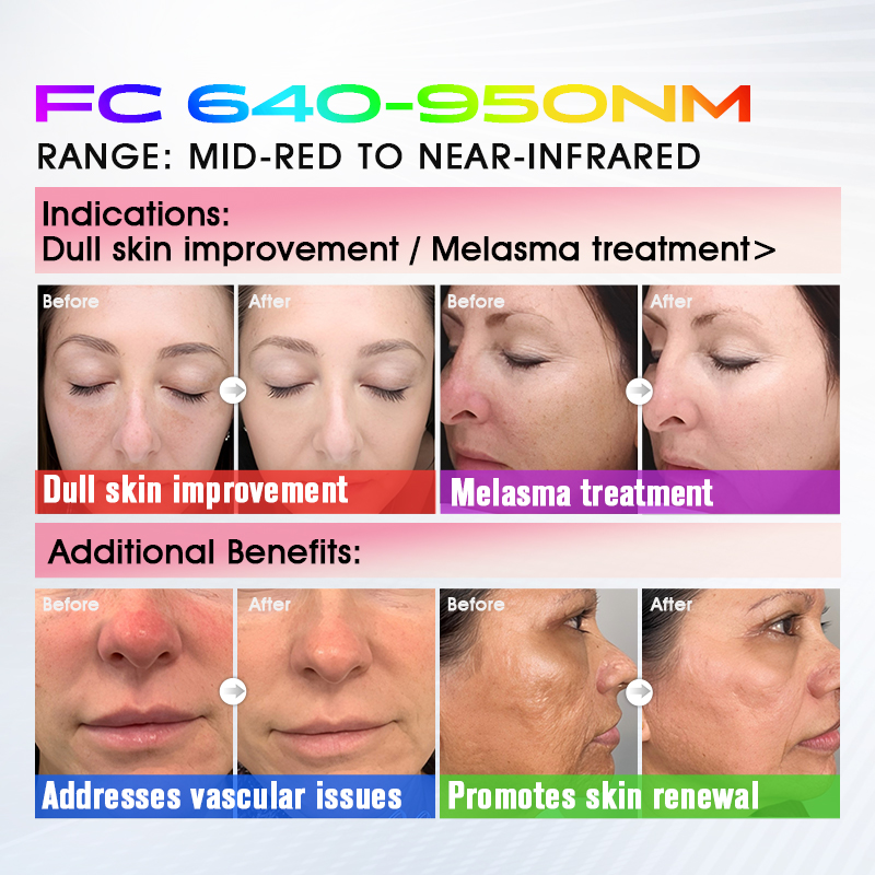 FC 640-950nm skin result