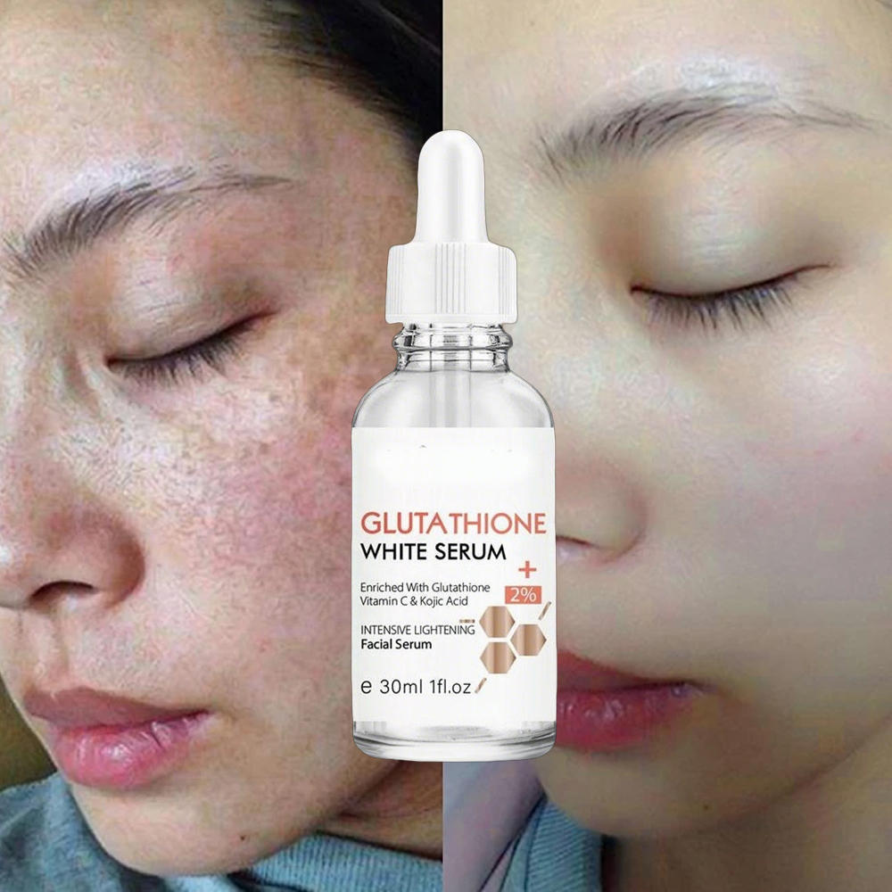 Glutathione Skin Lightening Serum for Hyperpigmentation
