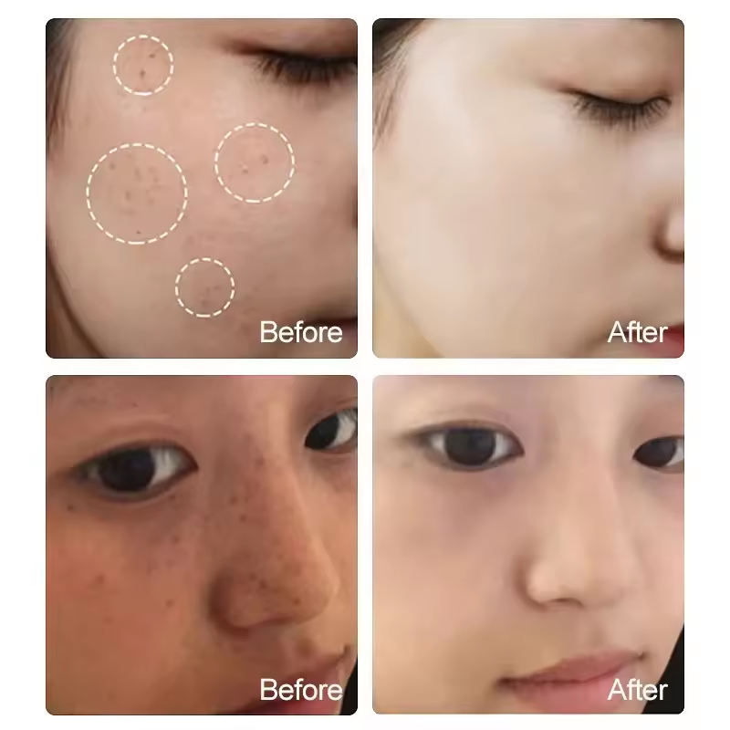 LIFITT Private Label Skin Care Serum Vitamin C Koji Acid Lighting Facial Serum Skin Freckle Brightening Serum