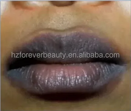 Custom Lip Whitening Treatment Peptide Collagen Lips Treatment Private Label for Dry Crackle Dark Lips
