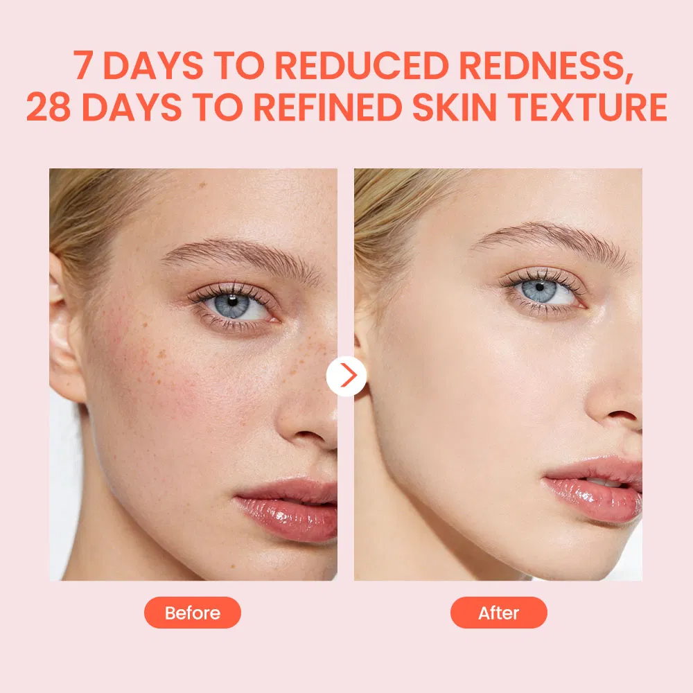 Suero facial de esencia reparadora de mucina de caracol 4