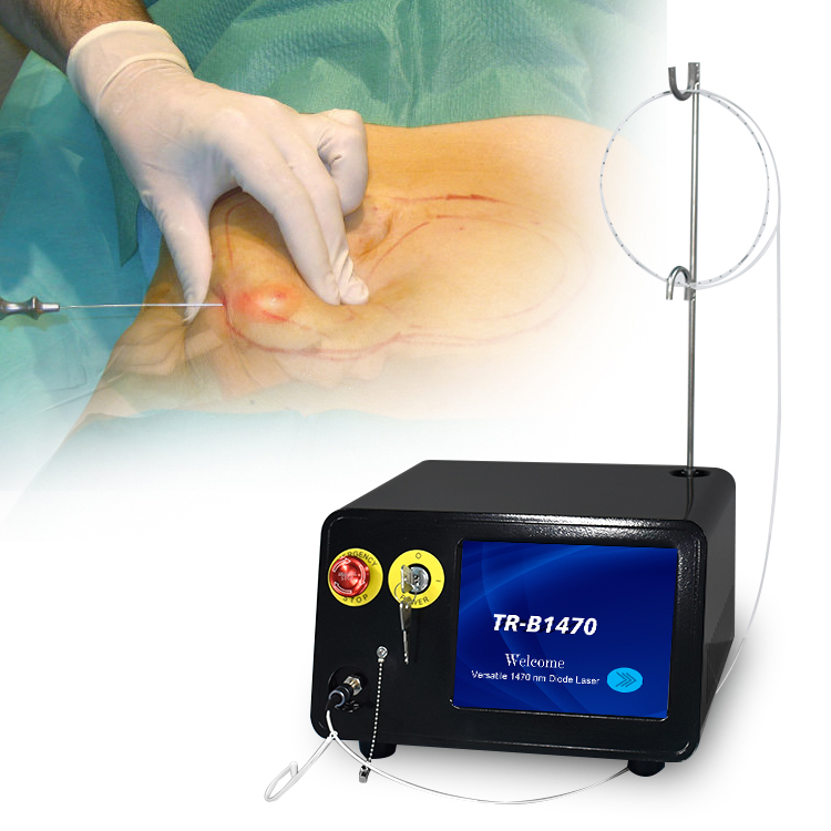 Venta Caliente de Triangel Factory 1470nm Máquina de Cirugía Plástica de Liposucción con Láser de Diodo Lipólisis Láser Doble Papada Endoláser Lifting Facial