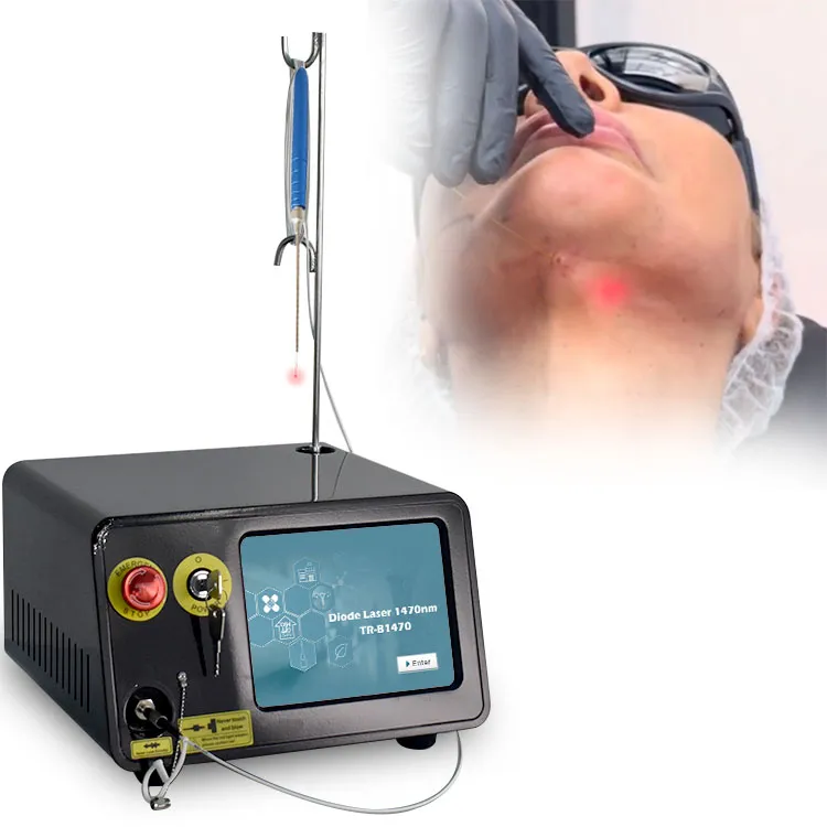 Láser de Diodo Lipólisis Láser Doble Papada Endoláser Lifting Facial