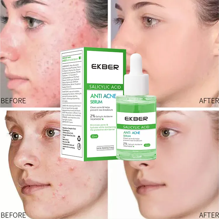 Sérum facial coreano de alta calidad con ácido salicílico, antiacné, reparador, reafirmante, nutritivo, iluminador, cuidado de la piel, tratamiento para el acné