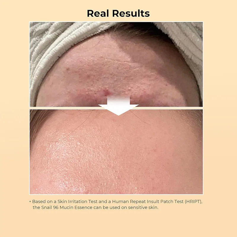 Suero de mucina de caracol 96%