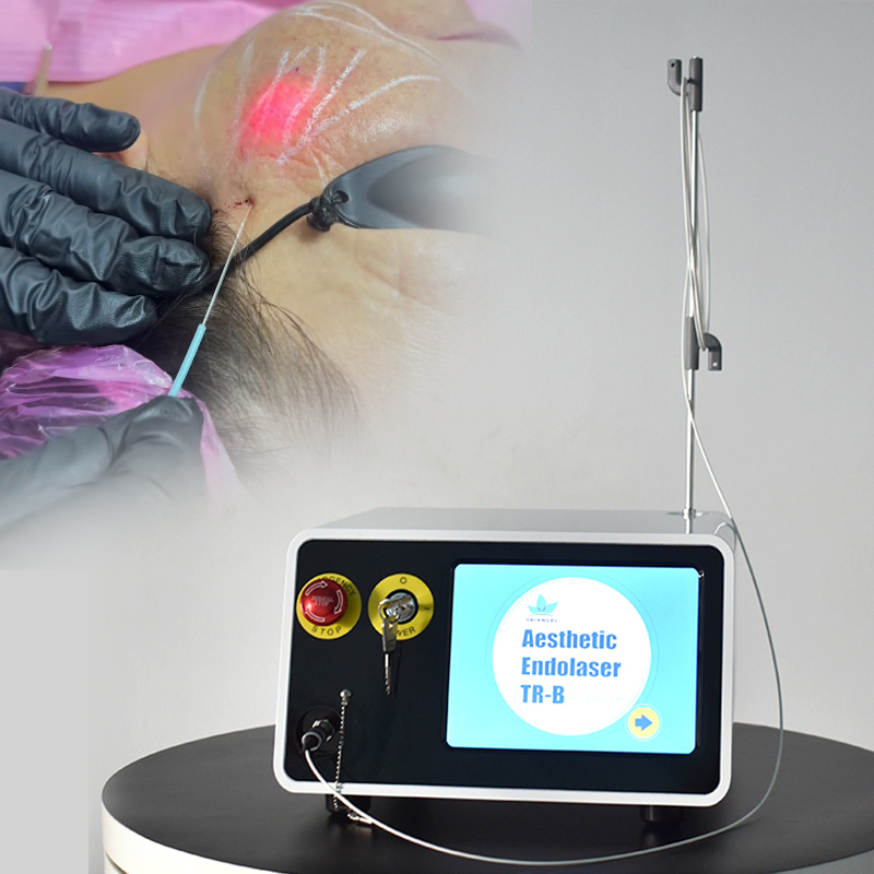 2 Longitudes de onda 980nm 1470nm Láser de diodo para la reducción de grasa corporal y lipólisis, lifting facial con endoláser