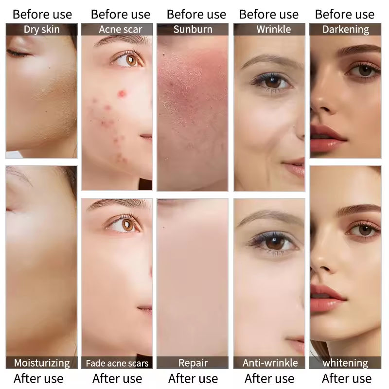 Suero facial de colágeno, ácido hialurónico, vitamina 8d, péptido