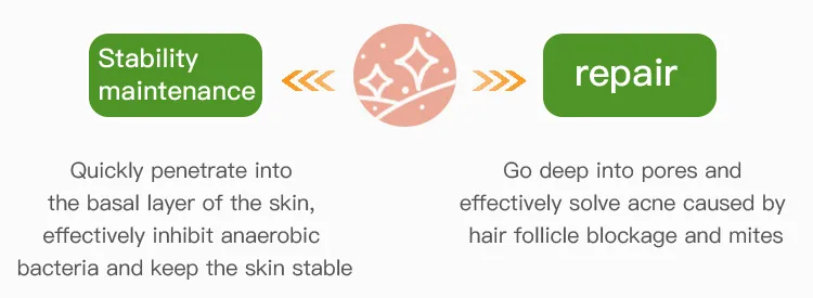 Suero Facial Exfoliante Anti Acné de Marca Privada 30ml Tratamiento Removedor Reparador de Piel Suero de Ácido Azelaico
