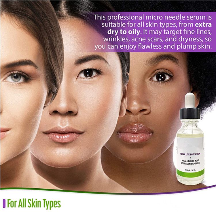 Suero de Microneedling Premium OEM/ODM con Péptidos de Colágeno y Suero EGF