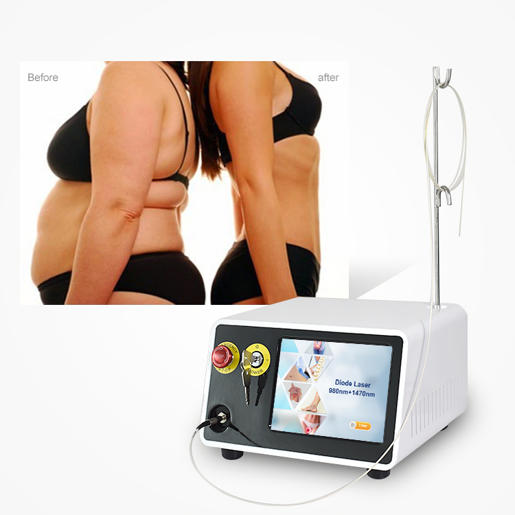 2023 Mejor Vendedor Profesional de Fibra Óptica para Lifting Facial y Lipólisis 1470nm Máquina de Láser Endo