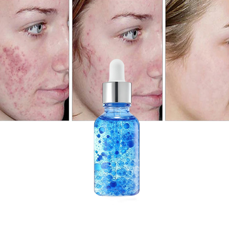 Reduce el enrojecimiento, líneas finas, suero facial de péptidos de cobre azul para piel sensible