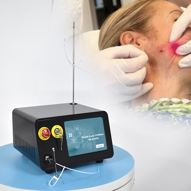 Venta Caliente de Triangel Factory 1470nm Máquina de Cirugía Plástica de Liposucción con Láser de Diodo Lipólisis Láser Doble Papada Endoláser Lifting Facial
