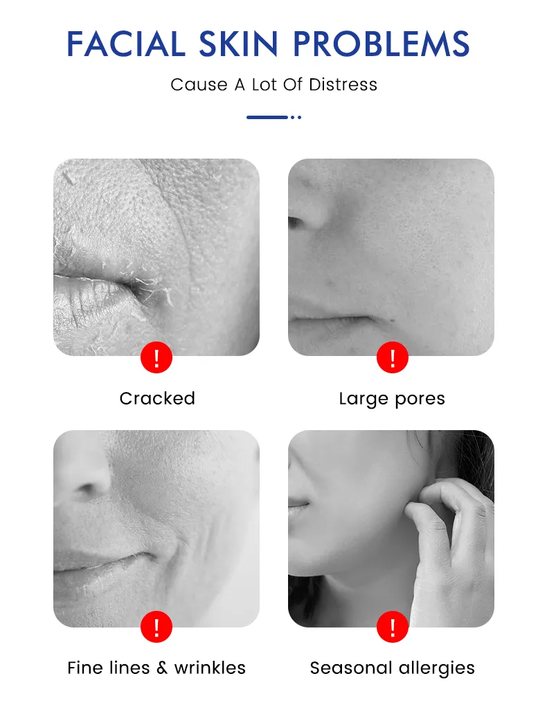 Suero Facial Antienvejecimiento Orgánico Retinol Astaxantina Niacinamida Vitamina C Ácido Hialurónico Cara 5 en 1 Suero