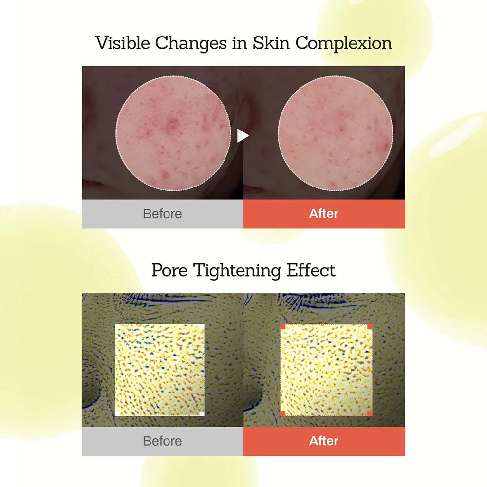 Suero Natural para la Piel Cuidado Centella Niacinamida Antienvejecimiento Blanqueador Calmante