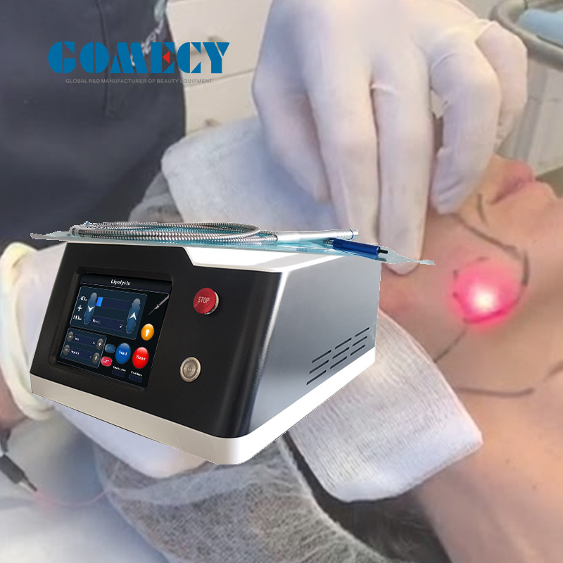 2024 Nuevo Lifting Facial con Láser de Fibra Óptica Profesional para Tensar la Piel 980nm 1470nm Máquina de Endoláser