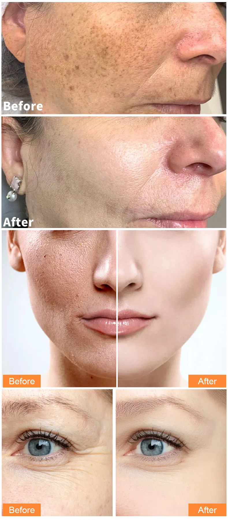 Suero facial iluminador de cúrcuma natural para el cuidado de la piel, suero facial blanqueador de vitamina C