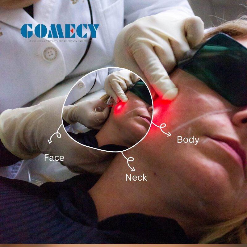 Máquina de Fibra Óptica de Doble Longitud de Onda Endoláser para Apretar la Piel Lipólisis para Lifting Facial Cánulas de Liposucción Diode 980nm 1470nm