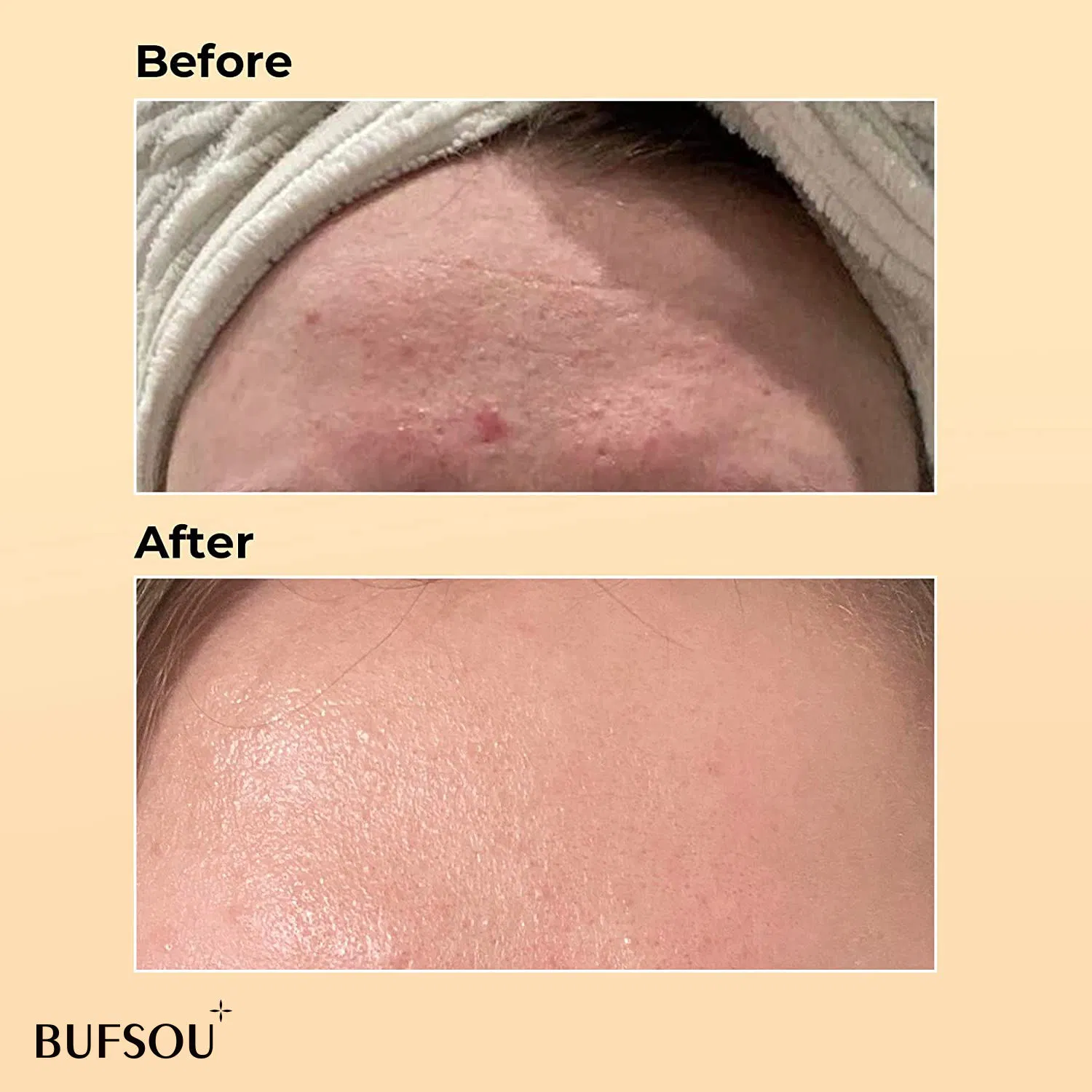 OEM Coreano 96% Mucina de Caracol Cuidado de la Piel Antienvejecimiento Suero Facial Blanqueador Reparador Suero de Caracol para Piel Sensible