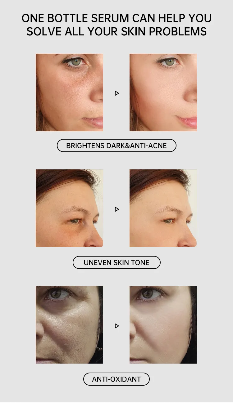 Suero Facial Blanqueador y Aclarador de Cúrcuma con Retinol y Ácido Hialurónico