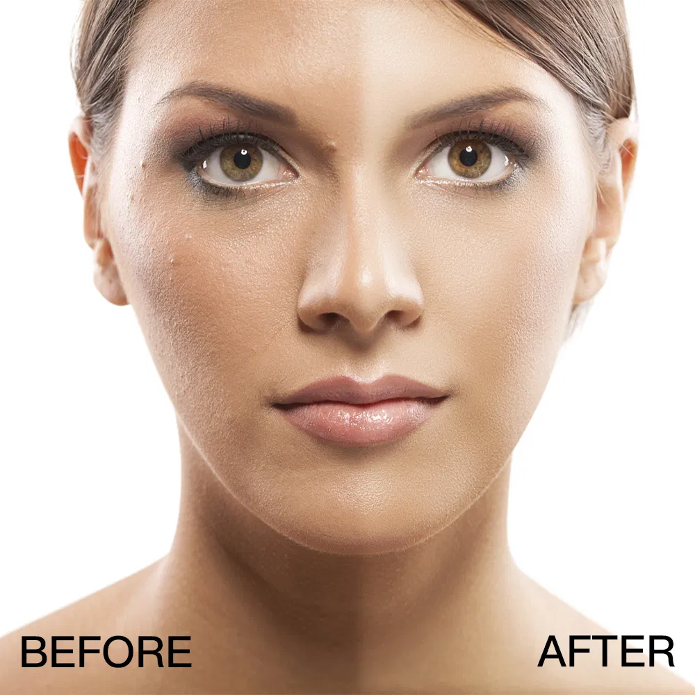 Salón de Belleza OEM ODM EGF Oligopéptido Reparación Facial Blanqueamiento Cuidado de la Piel Reparador Calmante Hidratante Suero Facial