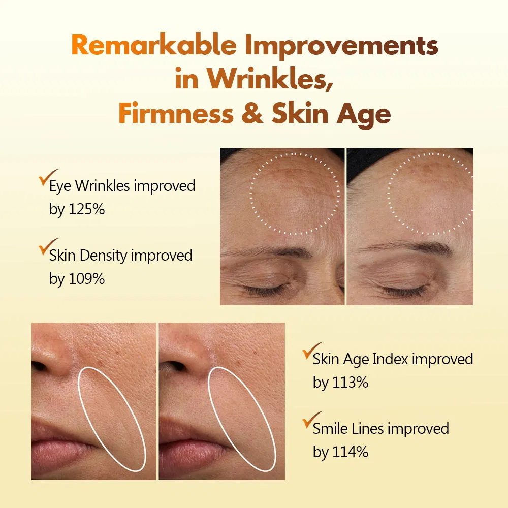 Suero Facial de Retinol Vegano Líquido de Niacinamida Blanqueador Antienvejecimiento Suero Calmante