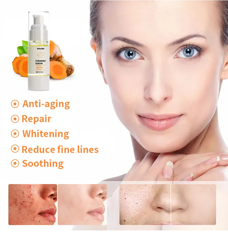 Suero facial iluminador de cúrcuma natural para el cuidado de la piel, suero facial blanqueador de vitamina C