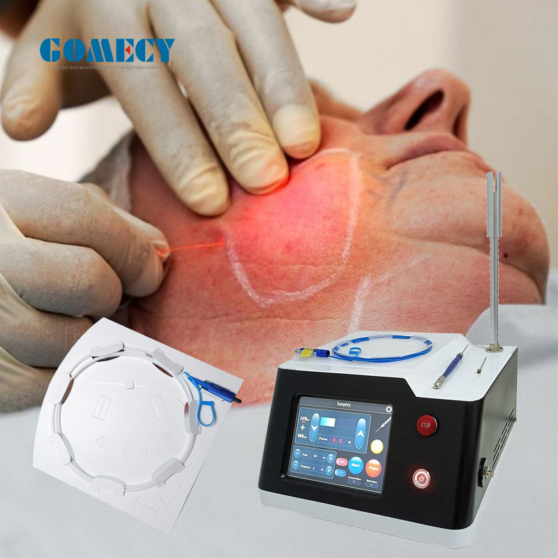 Nuevo Equipo de Belleza 2024 Endoláser Lipólisis Láser No Quirúrgica para Lifting Facial 980nm1470nm Láser de Liposucción Diode Endolift