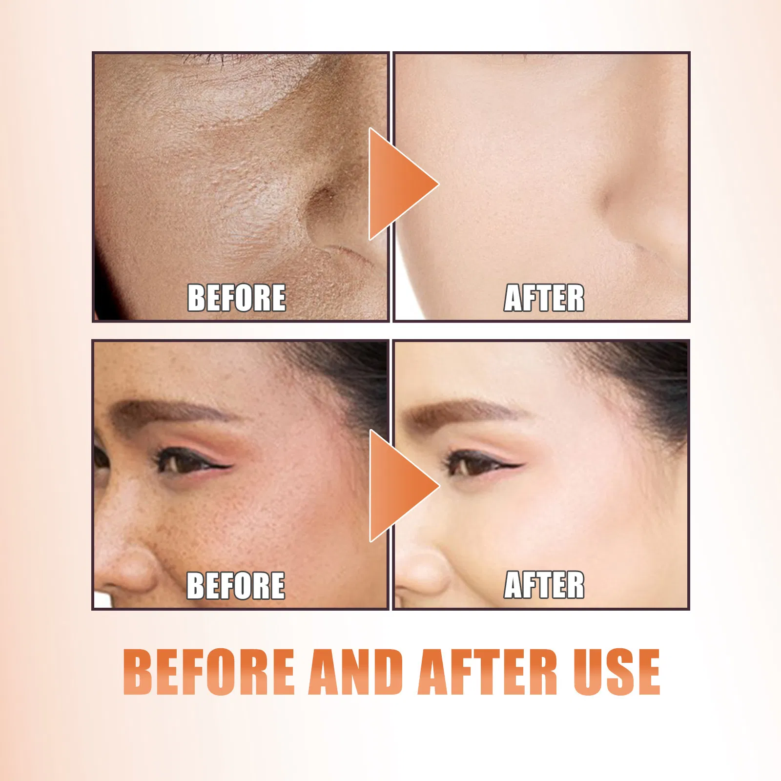 Suero facial iluminador y embellecedor, reafirmante, hidratante, humectante y reparador de la piel