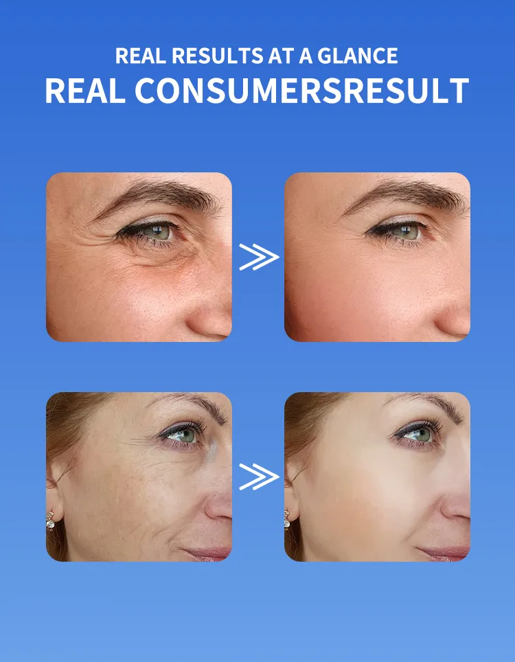 Reduce el enrojecimiento, líneas finas, suero facial de péptidos de cobre azul para piel sensible