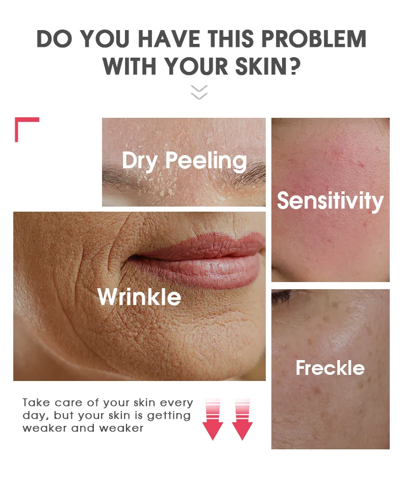 Suero facial personalizado de sodio ADN para corrección de melanina en la piel