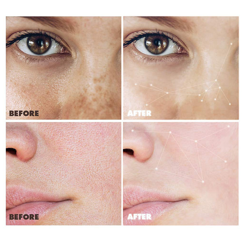 Suero Facial Aclarador Iluminador de Vitamina C Orgánica Pura 20%