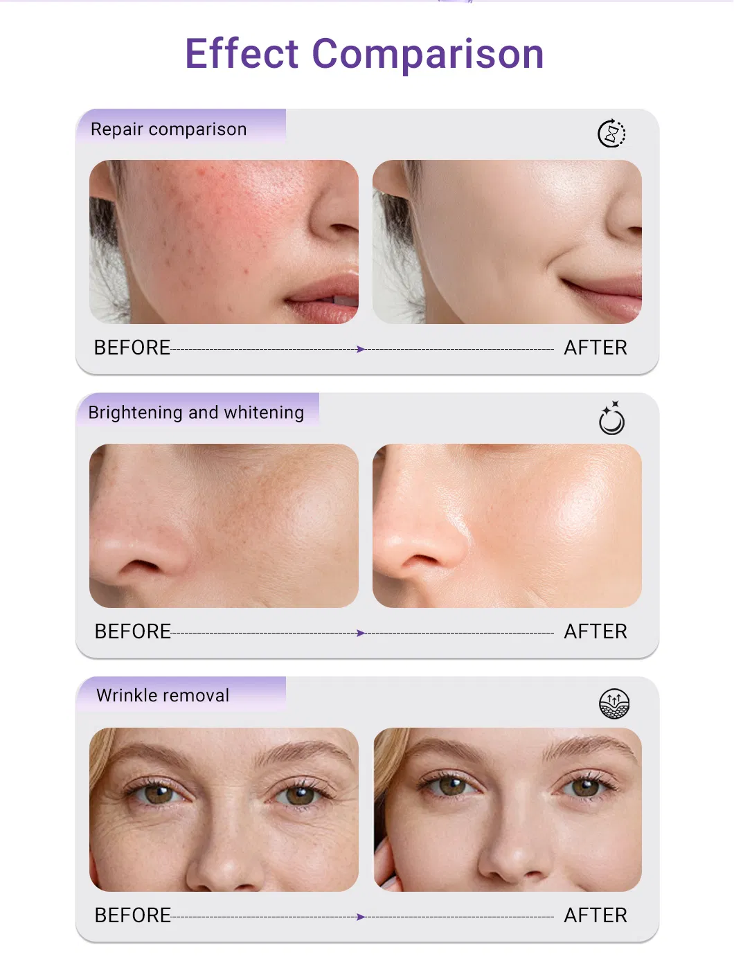 OEM Inyectable Acelerador de Piel Pdrn Mesoterapia para Rejuvenecimiento Facial 3ml*5