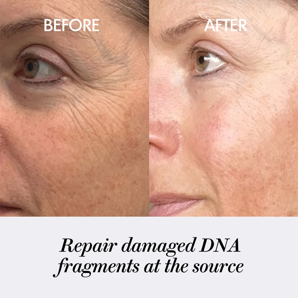 Sérum facial reparador de colágeno anti-envejecimiento calmante de Centella Nad Exosome