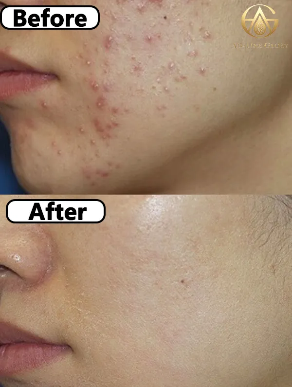 After treatment status