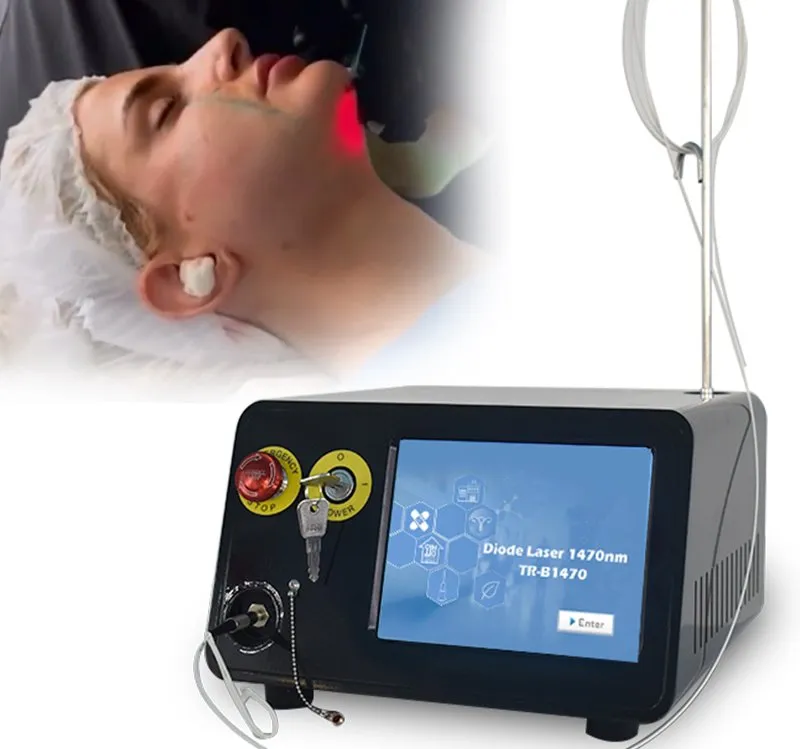 Tratamiento Láser de Diodo Lipólisis Láser Doble Papada Endoláser Lifting Facial