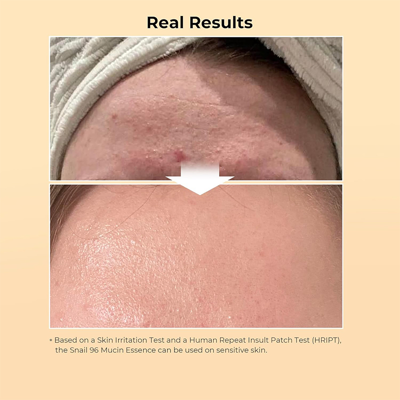 Suero facial antienvejecimiento de colágeno y caracol de cuidado natural de la piel Corea