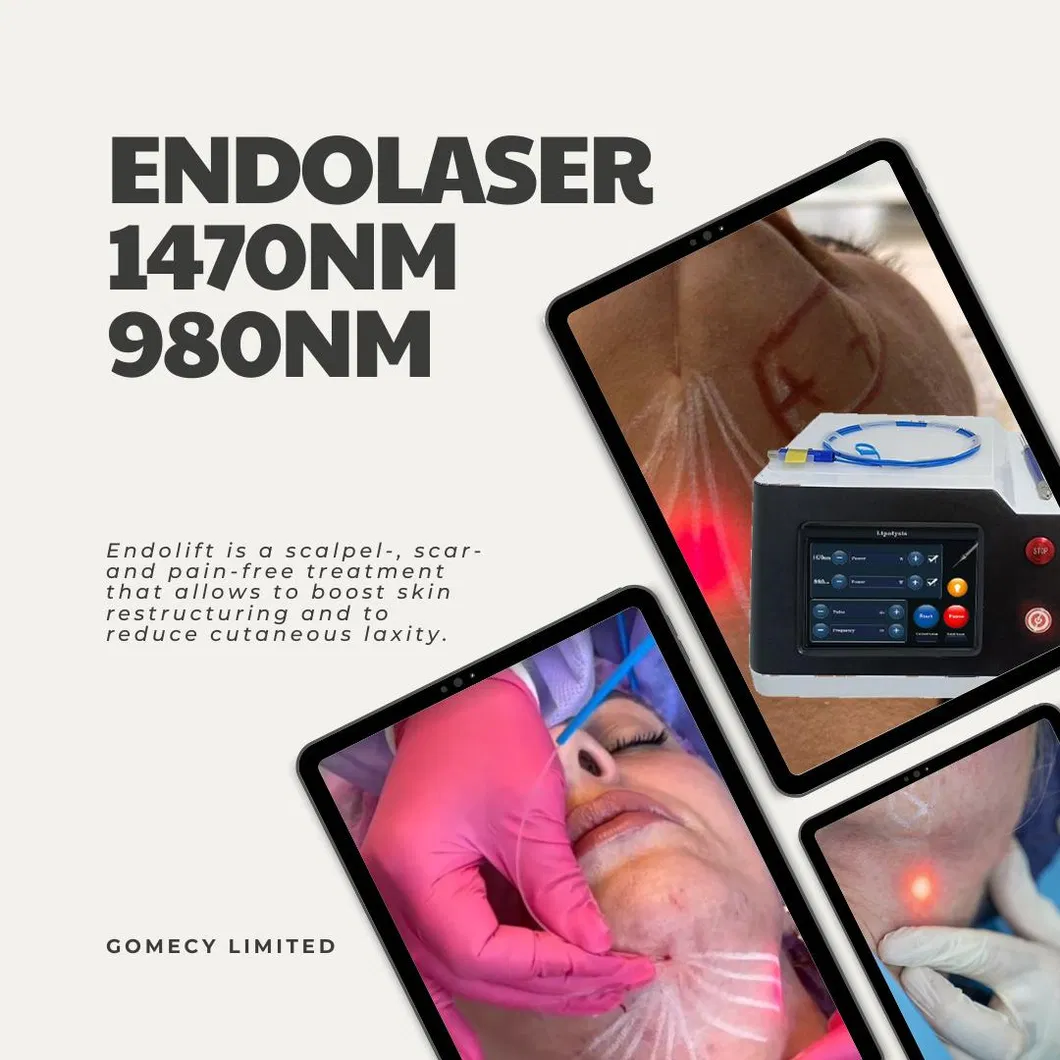Nuevo Equipo de Belleza 2024 Endoláser Lipólisis Láser No Quirúrgica para Lifting Facial 980nm1470nm Láser de Liposucción Diode Endolift