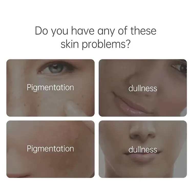 Suero facial de marca privada ácido hialurónico retinol cuidado de la piel hidratante reparador suero para el rostro
