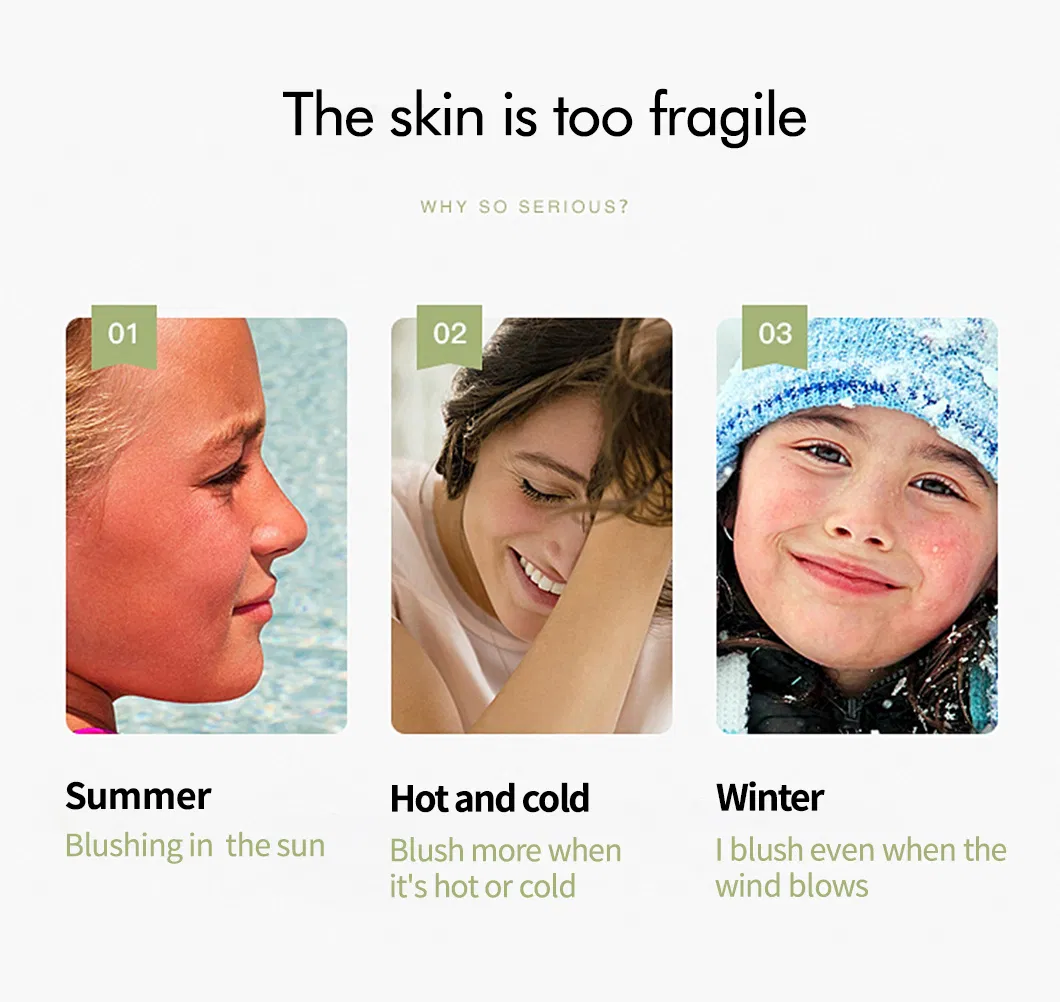 Esencia de Piel de Planta Herbal de Manzanilla Suavizante Hidratante Suero Facial