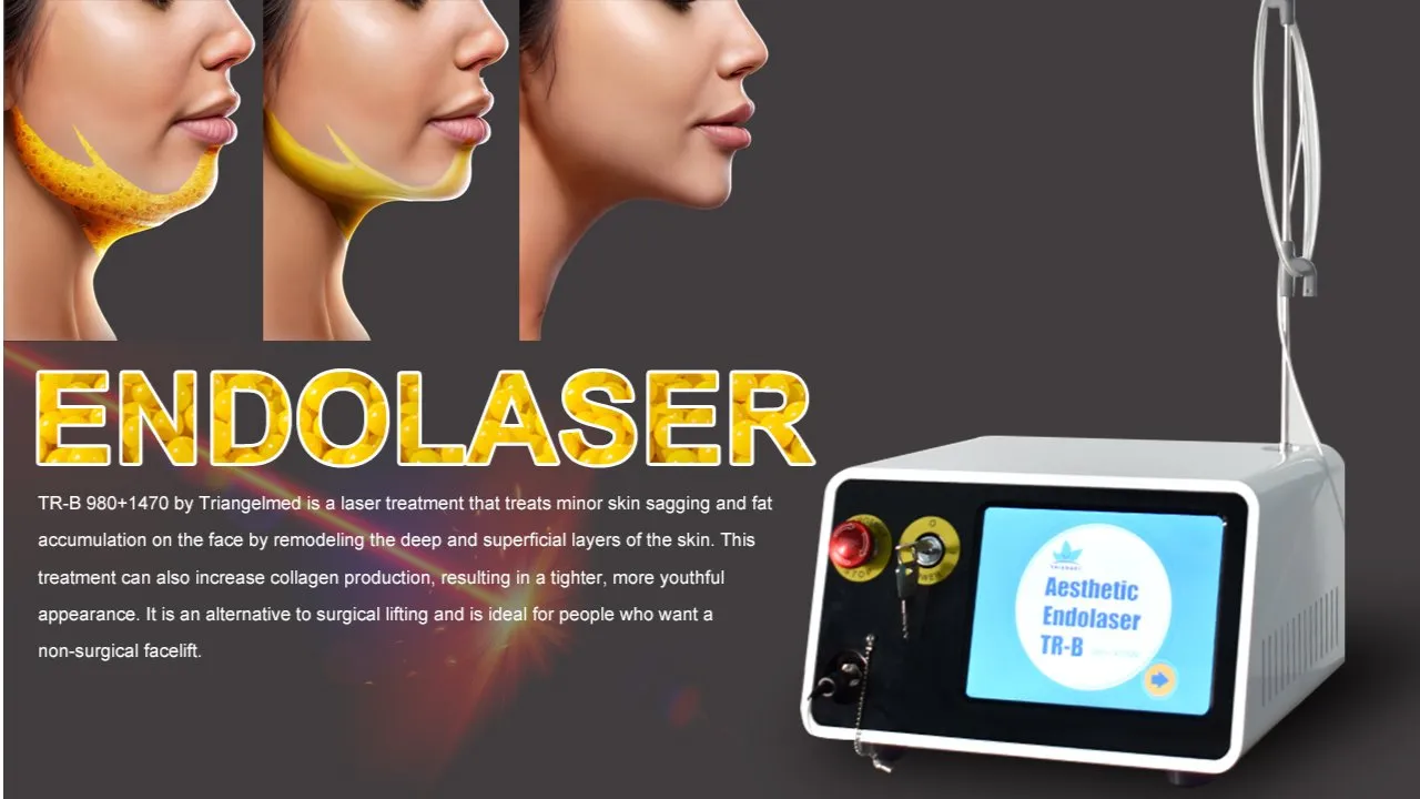 Láser Endo Profesional de Fibra Óptica para Lifting Facial y Lipólisis
