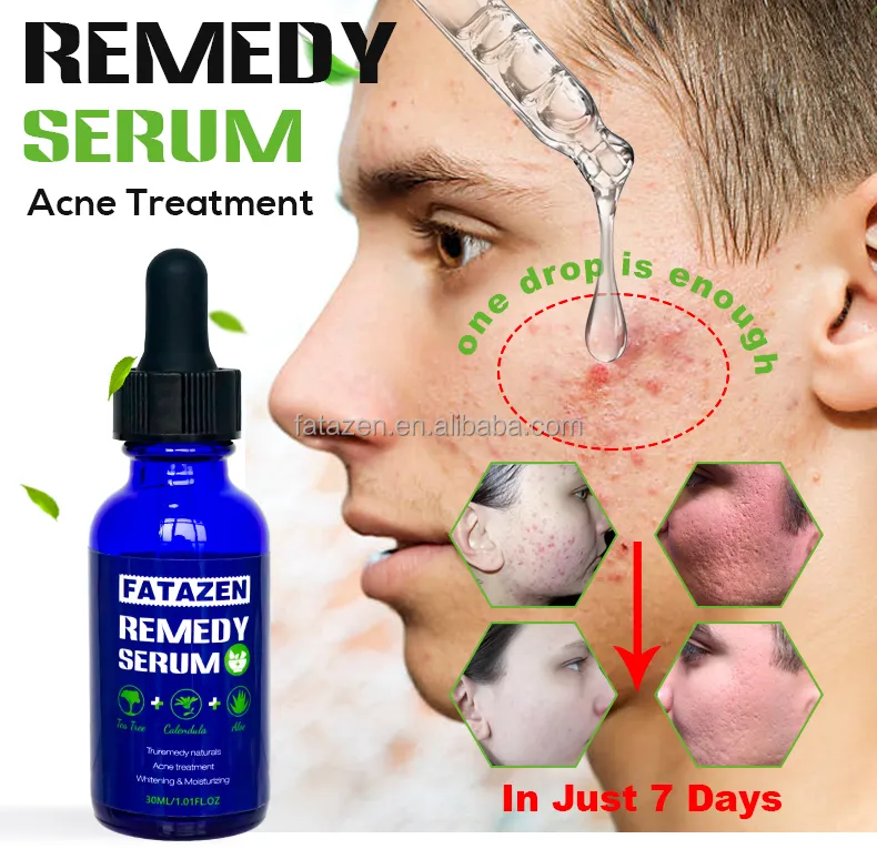 Productos de Cuidado de la Piel de Marca Privada Suero Antiinflamatorio Suero Hidratante Iluminador Reparador para el Rostro