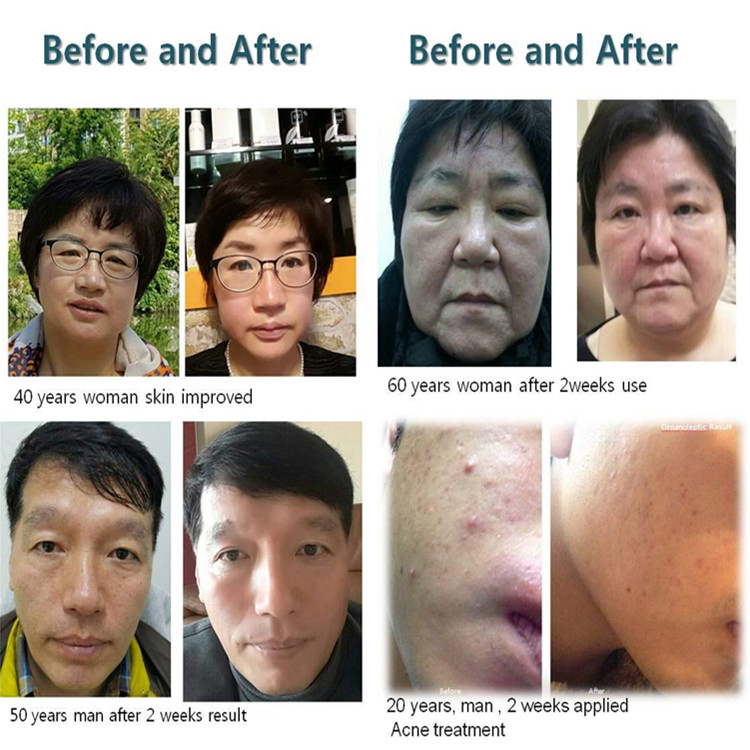 Suero Facial de Péptidos y Células Madre de Cosméticos Super Avanzados de Corea