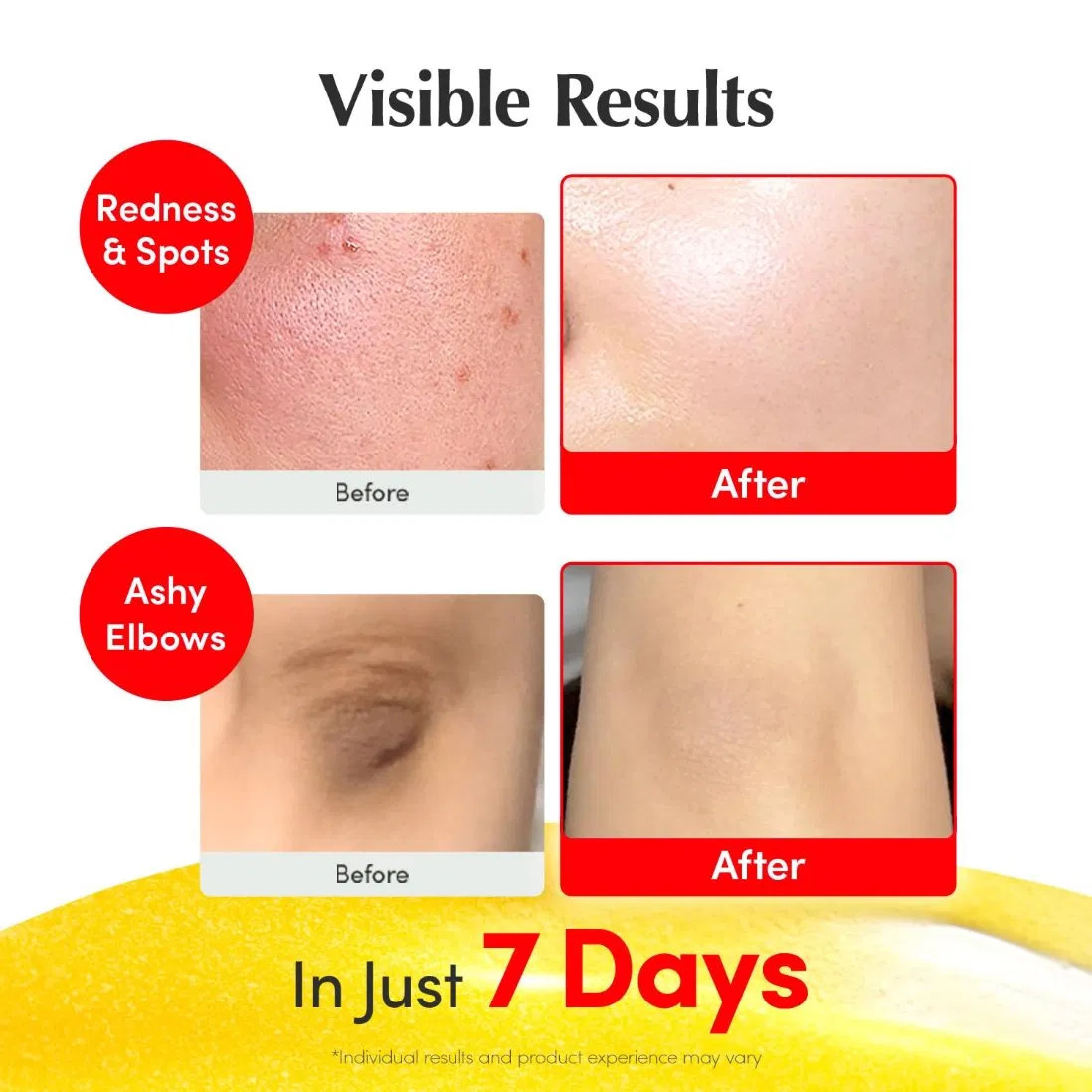 Suero Iluminador de Vitamina Niacinamida 4% + Suero de Piel de Vitamina C Aclaradora Cuidado de la Piel Coreano