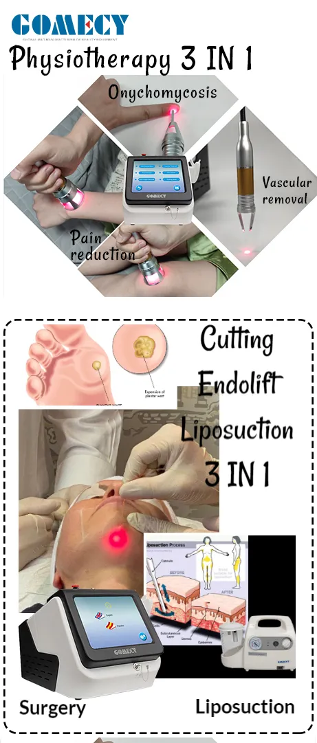Máquina de Fibra Óptica de Doble Longitud de Onda Endoláser para Apretar la Piel Lipólisis para Lifting Facial Cánulas de Liposucción Diode 980nm 1470nm