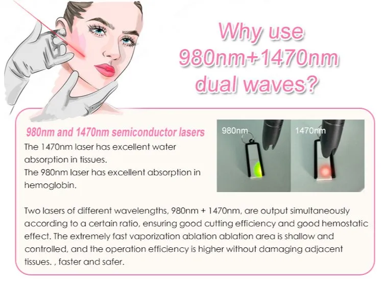 Cirugía Plástica Láser de Fibra para Lifting Facial 980nm 1470nm 47W Lipólisis Máquina de Elevación Endoláser