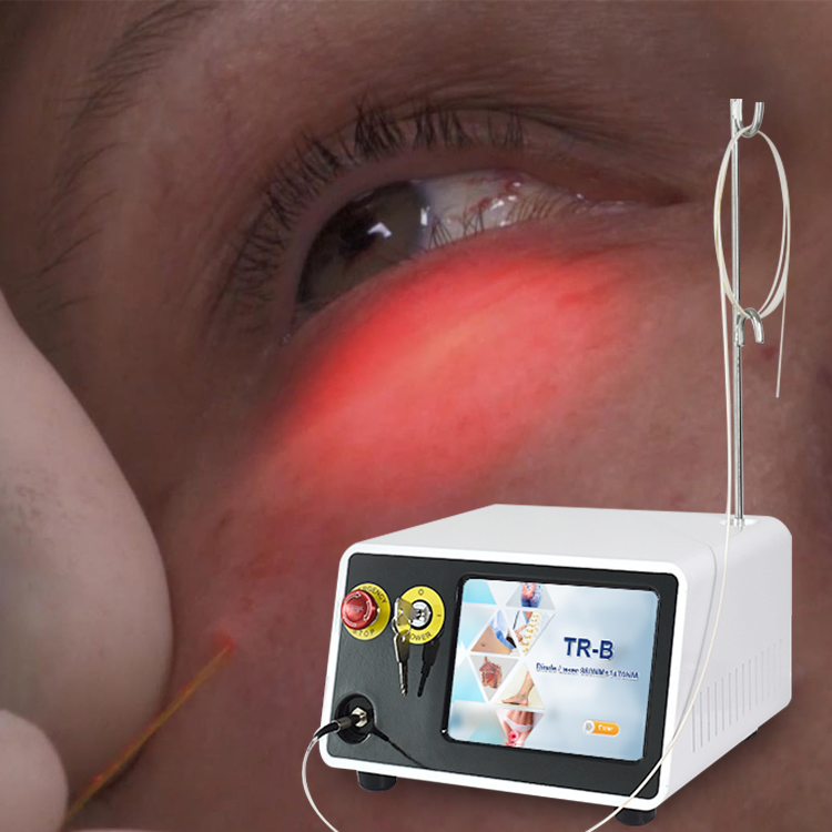 2023 Mejor Vendedor Profesional de Fibra Óptica para Lifting Facial y Lipólisis 1470nm Máquina de Láser Endo