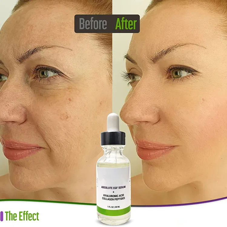 Suero de Microneedling Premium OEM/ODM con Péptidos de Colágeno y Suero EGF