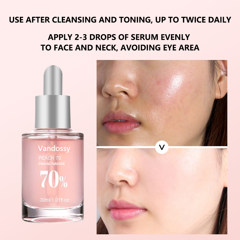 Sérum Facial Hidratante Antienvejecimiento Iluminador de Niacinamida de Durazno