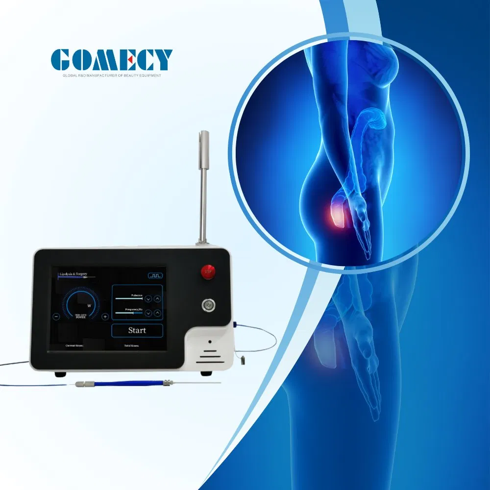 Equipo de láser Evlt/ Tratamiento Evlt Tratamiento de dolor en las venas de las piernas Clase 4 Láser en venta Variceslaser Endovascular PARA Varices Disolviendo grasas