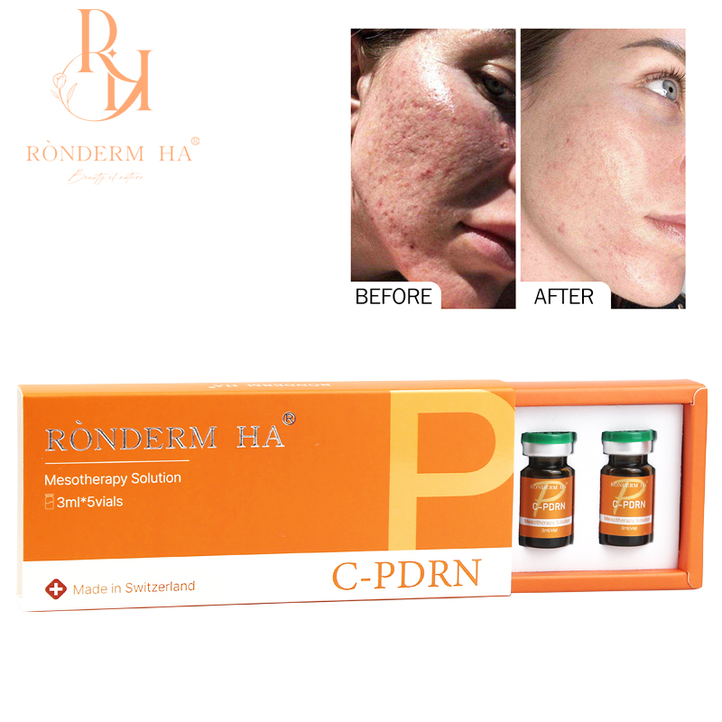OEM Inyectable Acelerador de Piel Pdrn Mesoterapia para Rejuvenecimiento Facial 3ml*5